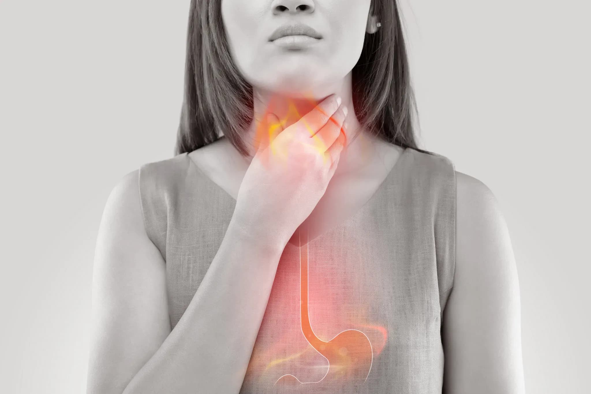Irritable Bowel Syndrome